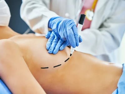 Bruststraffung und psychologische Auswirkungen