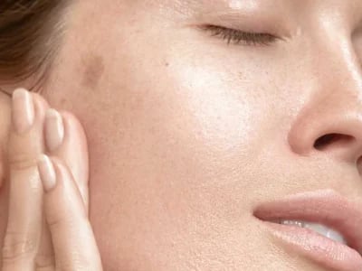 MorySkin: Volumen und Frische mit juvederm volift erreichen