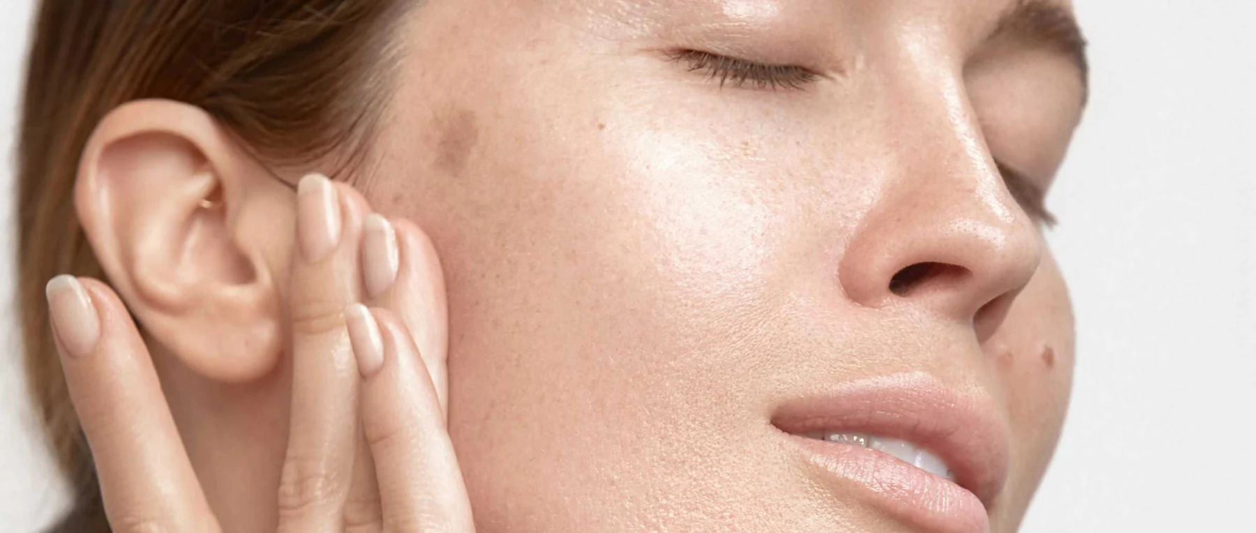 MorySkin: Volumen und Frische mit juvederm volift erreichen